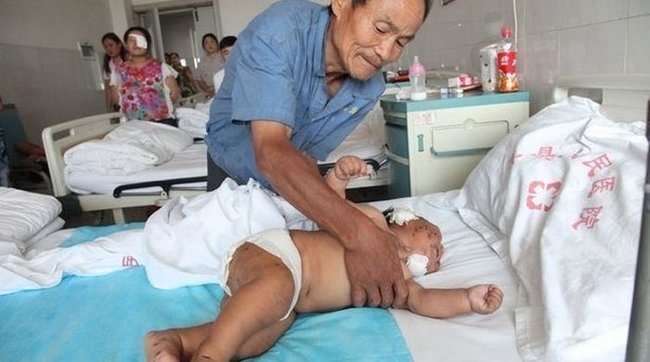 Ana övladına qida verən zaman üzünü qayçı ilə 90 dəfə kəsib