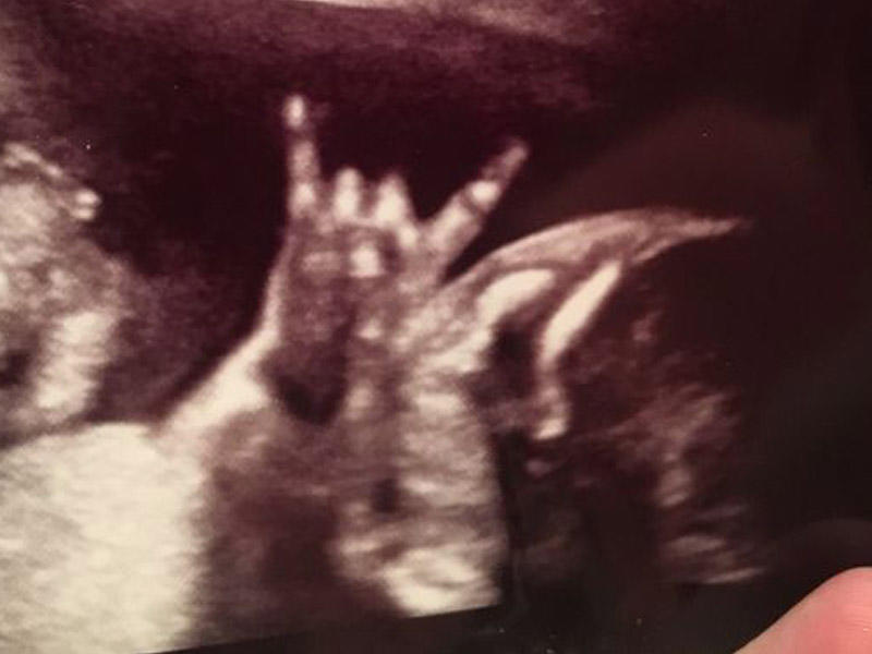 Hamilə qadın şokda: qarnında 