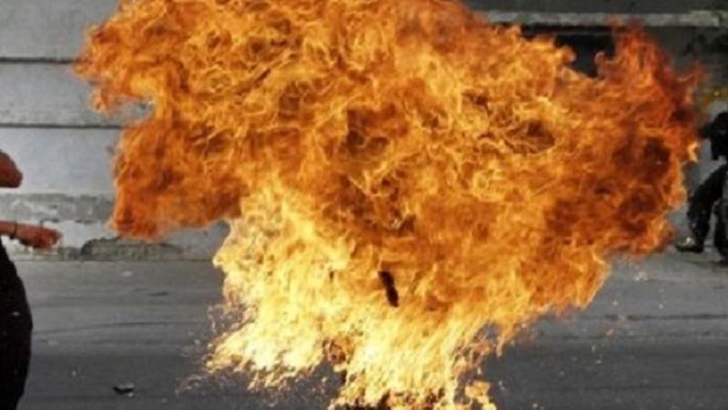 Maştağada 26 yaşlı oğlan özünü yandırdı