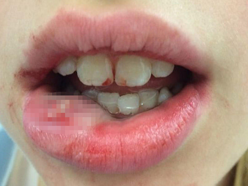 Həkim 13 yaşlı qızı