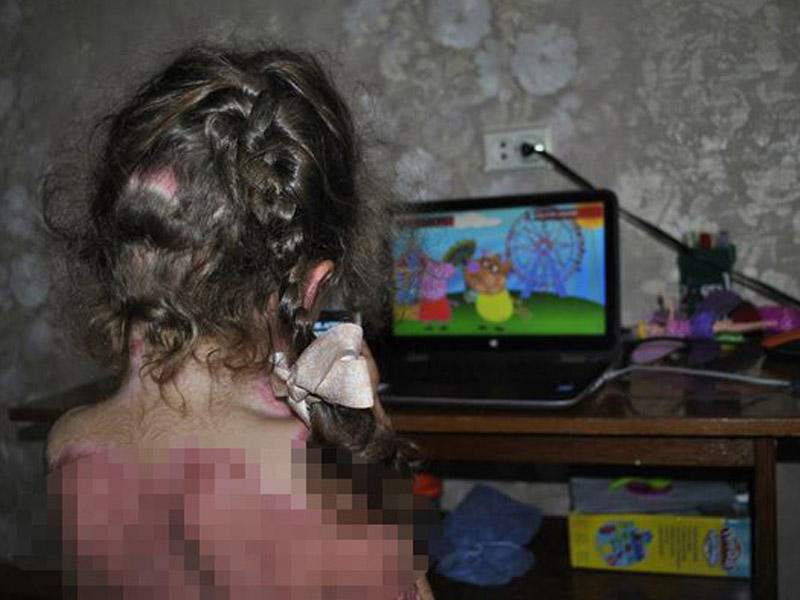 Valideynlər, DİQQƏT: uşaqlarınızı bu oyundan qoruyun - 5 yaşlı qız oyunun qurbanı oldu - FOTOLAR