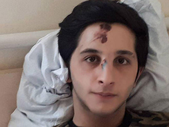 Faciəvi qəzada yaralanan Əfsər: 