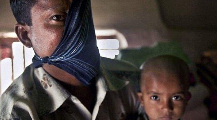 20 il əvvəl pələng hücumuna məruz qalan şəxs üzünü nümayiş etdirdi - FOTOLAR