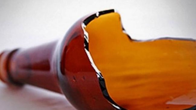 Bakıda şadlıq evində İNSİDENT: Sintezator çalanın başına butulka çırpdılar, üzünü kəsdilər