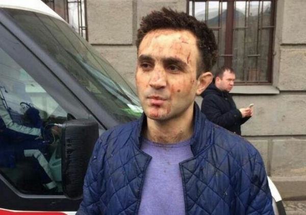 Metrodakı terrorda yaralanan Zaur: