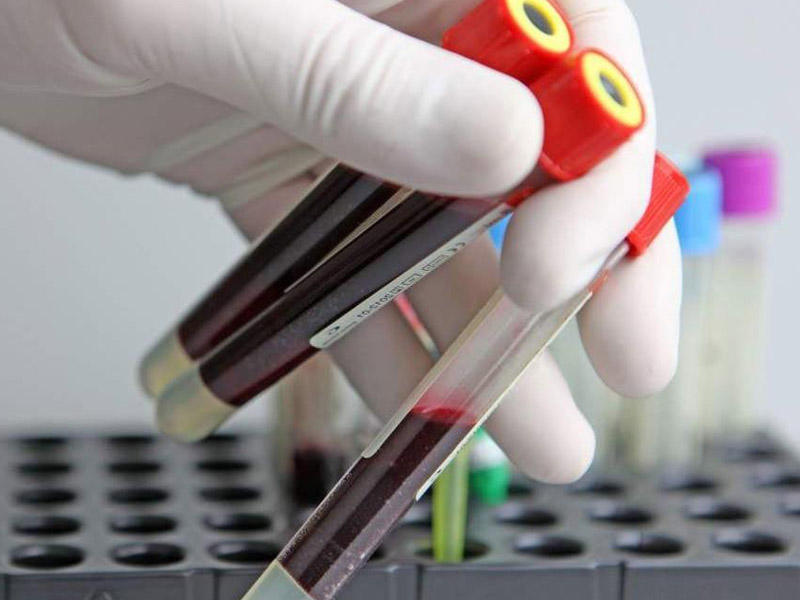 Rusiyadan Azərbaycana məhsul idxalına qadağa qoyula bilər? - RƏSMİ AÇIQLAMA