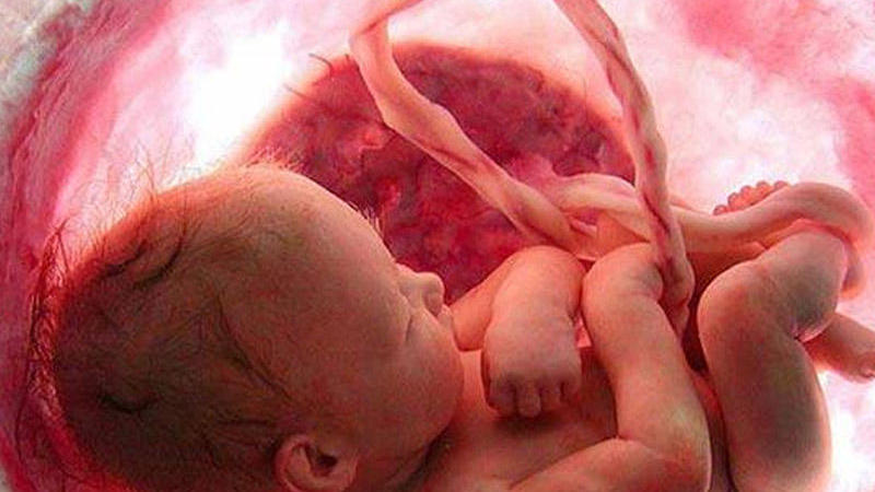 Əkiz uşaqların ana bətnində etdiyi hərəkət hamını HEYRƏTLƏNDİRDİ - FOTO