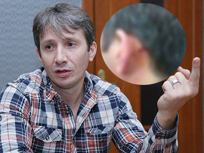 Azərin çəkilişdə qulağı cırıldı