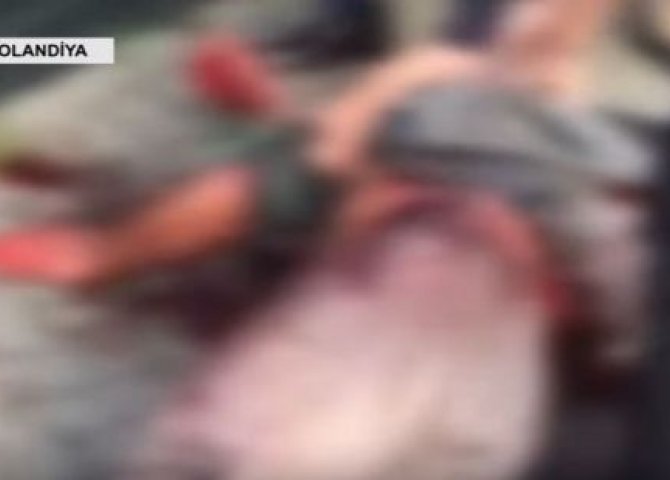 Surət Hüseynovun bıçaqlanan mühafizəçisinin dəhşətli görüntüləri yayıldı - VİDEO +18