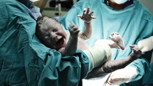 Bakıda özəl klinikada həkim SƏHLƏNKARLIĞI: Doğulan körpə iki gün sonra öldü