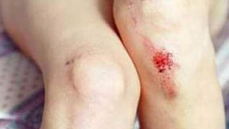 Şəhidlər xiyabanında 13 yaşlı qıza təcavüz edildi - FOTO