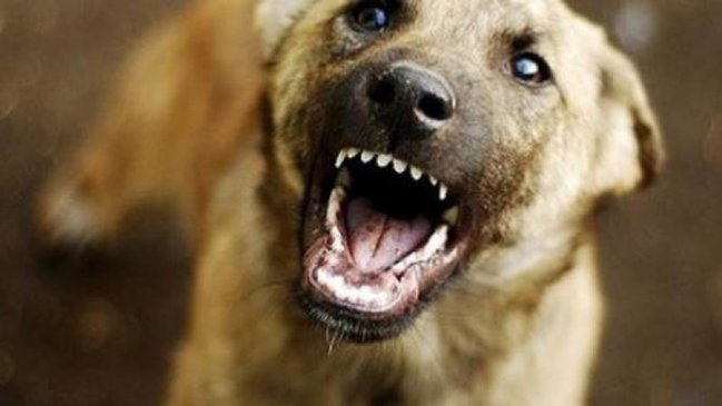 Bakıda it 3 yaşlı uşağın qulağını qopardı