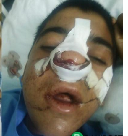 Şagirdi vəhşicəsinə döyüb şikəst edən müəllimin məhkəməsi başladı