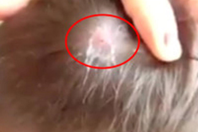 Oğlanın başından çıxan əşya görənləri dəhşətə gətirdi -VİDEO