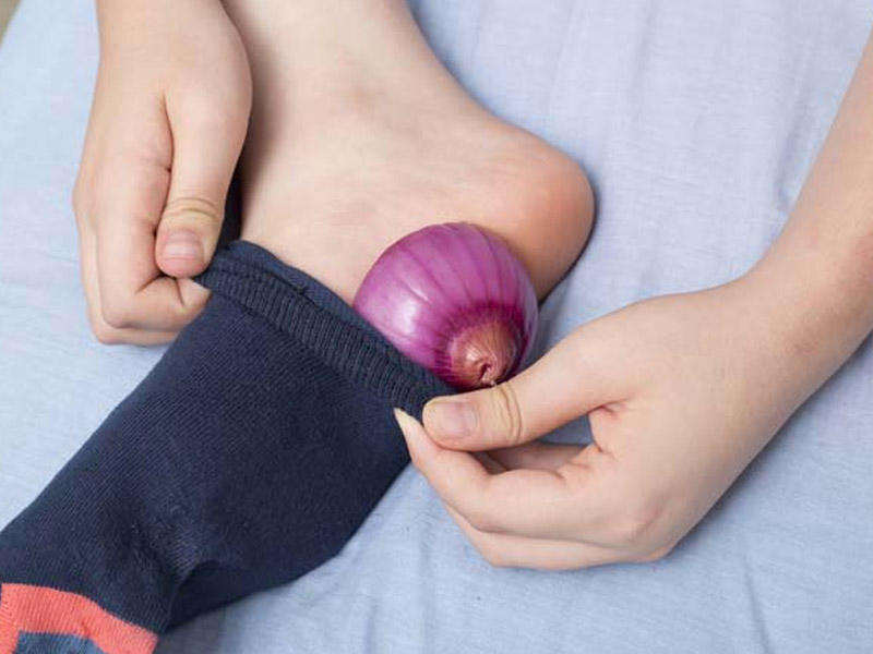 Soğanı bölüb corabın içinə qoysanız... - BUNLARI BİLİRSİNİZ?