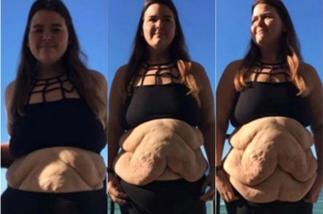 83 kiloqram arıqladı - İNANILMAZ GÖRKƏM ALDI - FOTOLAR