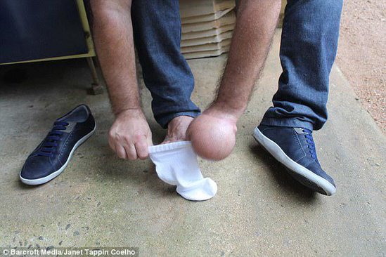 Ürəyi zəif olanlar buna baxmasın!Əlini görün harasına tikdilər - FOTOLAR