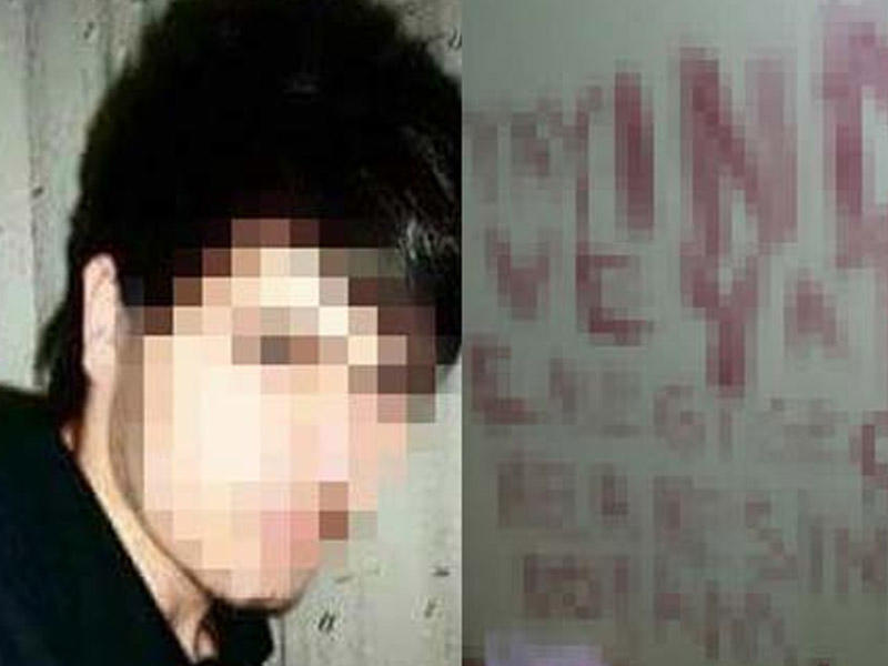 Cinsiyyət orqanını kəsib tualetə atdı -