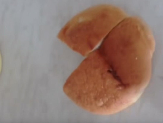 Vərəm dispanserində xəstələr görün nə ilə qidalanır-Nazirlikdən AÇIQLAMA