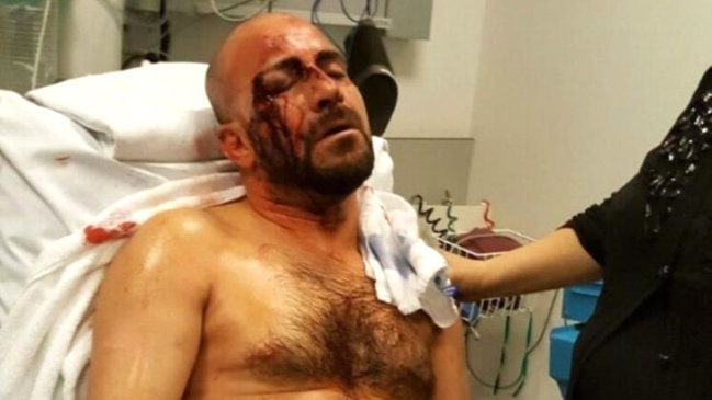 Belçikada Ərdoğan tərəfdarını vəhşicəsinə döydülər - FOTO