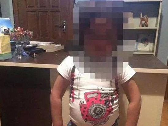 Bakıda döyülərək çılpaq küçəyə atılan Yağmur QİÇS xəstəsidir? - AÇIQLAMA