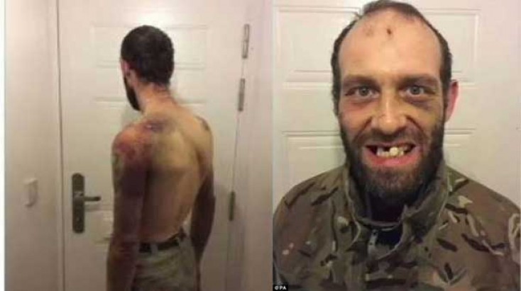 QADIN KIŞININ CINSIYYƏT ORQANINI KƏSDI VƏ... - ÖLÜMÜNDƏN ÖNCƏ ÇƏKILƏN FOTOLAR