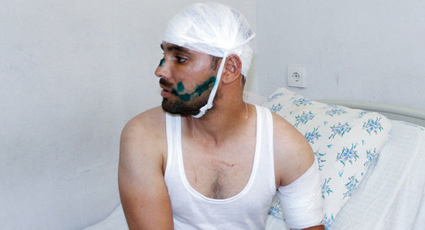 BAKIDA GECƏ QADIN MÜŞTƏRISININ EVINƏ GEDƏN TAKSI SÜRÜCÜSÜNÜN AĞZINI CIRDILAR – FOTO