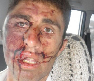 Kərəm Həsənovun əmisi oğlu vətəndaşı qanına qəltan edib! – ŞİKAYƏT