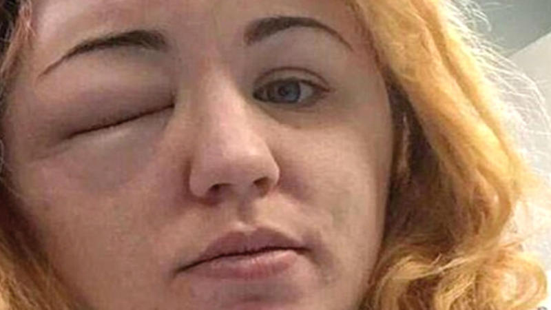 Saç rəngini dəyişmək istədi, başına gəlməyən qalmadı - FOTOLAR