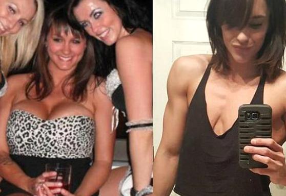 İri sinəsindən əməliyyatsız qurtuldu - fotolar