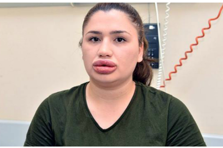 Azərbaycanda təhsil alan saxta həkim Adana həbsxanasından qaçıb — ŞOK HADİSƏ