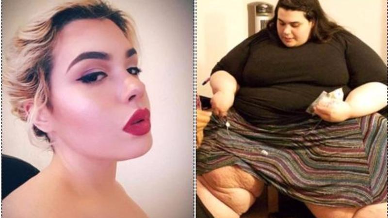 292 kiloqramlıq qadın arıqlayıb bu vəziyyətə düşdü - FOTOLAR