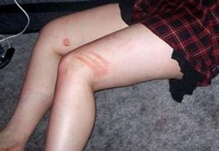 Sinif yoldaşları tərəfindən zorlanan məktəbli qız: “Mən 3 il idi zorlanırdım, amma...”