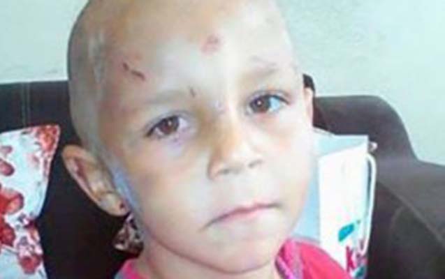 Valideynləri 4 yaşlı uşağı döyüb küçəyə atıblar? - Foto