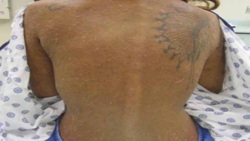 Meşədə 25 yaşlı qız tapdı, DƏHŞƏTƏ GƏLDİ: Çılpaq, bədəni dişlək-dişlək - FOTOLAR/VİDEO