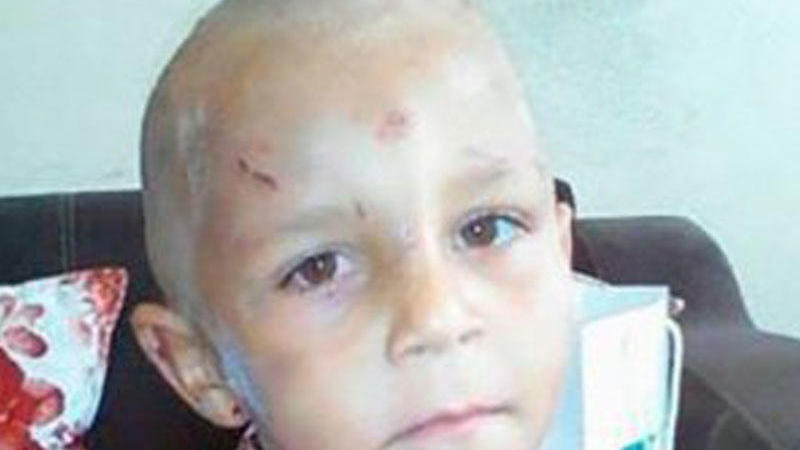 Bakıda döyülüb küçəyə atılan 4 yaşlı uşaqla bağlı DƏHŞƏTLİ FAKTLAR (YENİLƏNDİ)