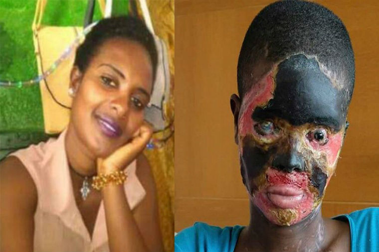 Efiopiyada dəhşətli cinayət — Arvadını bu hala saldı (FOTOLAR)