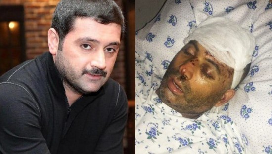 İzzət Bağırova görə döyülən şəxsin görüntüləri yayıldı: Vəziyyəti ağırdır - FOTO/VİDEO