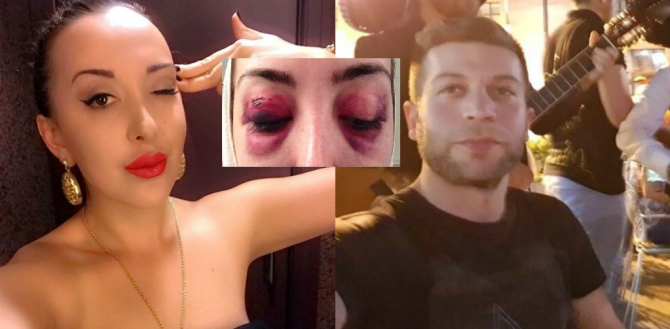 Azərbaycanda kişi keçmiş həyat yoldaşını ölümcül şəkildə döydü (FOTO)