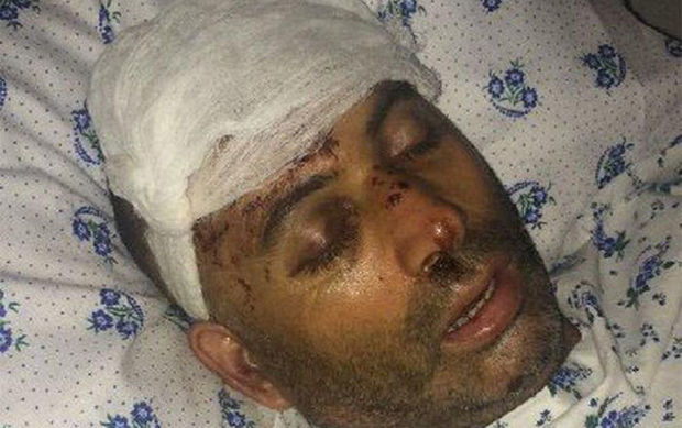 İzzət Bağırovun restoranda döydürdüyü şəxsin fotoları