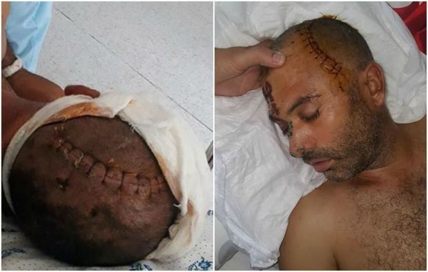 İzzət Bağırovun mühafizəçisinin döydüyü şəxsin vəziyyəti ağırdır