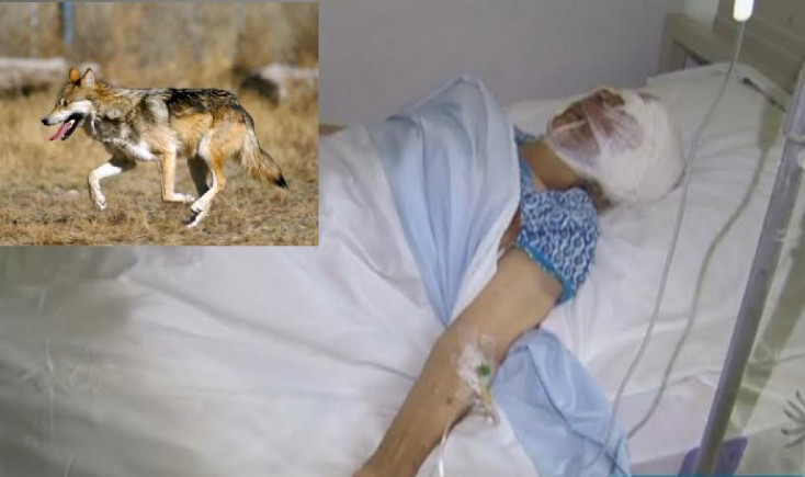 AZƏRBAYCAN: Çaqqallar toya hücum etdi - 5 yaralı var