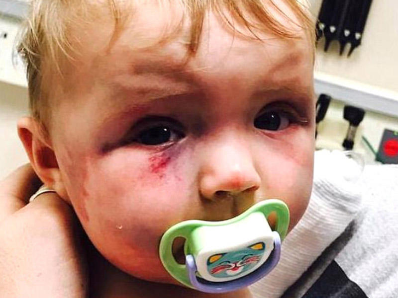 Ana qızını qaşıqla döydü, eyvandan atmaq istədi - FOTO