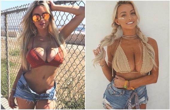 Sinəsinin böyüklüyündən gileyləndi - fotolar