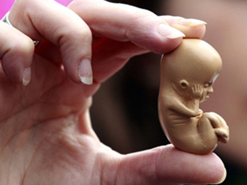 Qanunsuz abort edənləri 2 illik həbs cəzası gözləyir