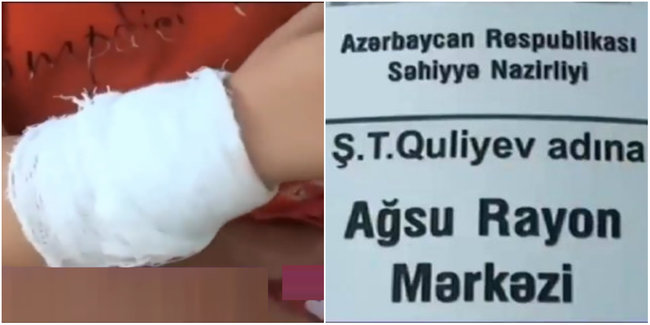 Ağsuda RƏZİLLİK: Azyaşlı uşağa YALANDAN sınıq diaqnozu QOYULDU - VİDEO