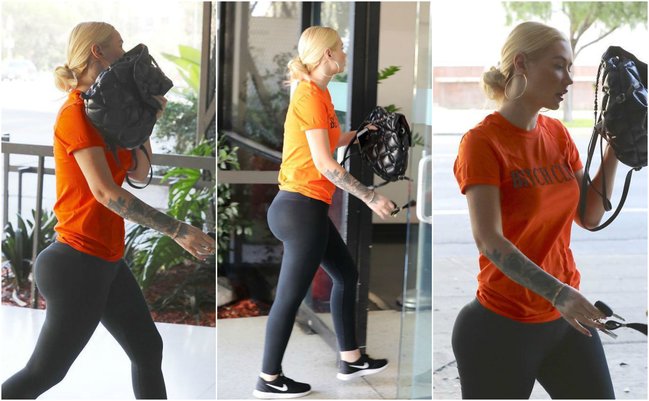 Məşhur müğənni ombasına plastik əməliyyat etdirdi - FOTOLAR