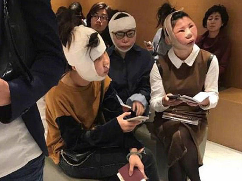 Plastik cərrahiyyə qurbanları - aeroportda gözlədilər - FOTO