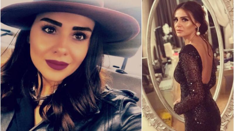 Əməliyyatla tanınmaz hala düşən Günel Zeynalovanın İbrahim Tatlısəslə münasibətləri korlandı – FOTO