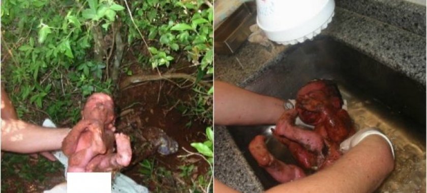 VƏHŞİLİK! Yeni doğulmuş körpəni 14 yerindən bıçaqlayıb diri-diri basdırdılar (+18 FOTOLAR)